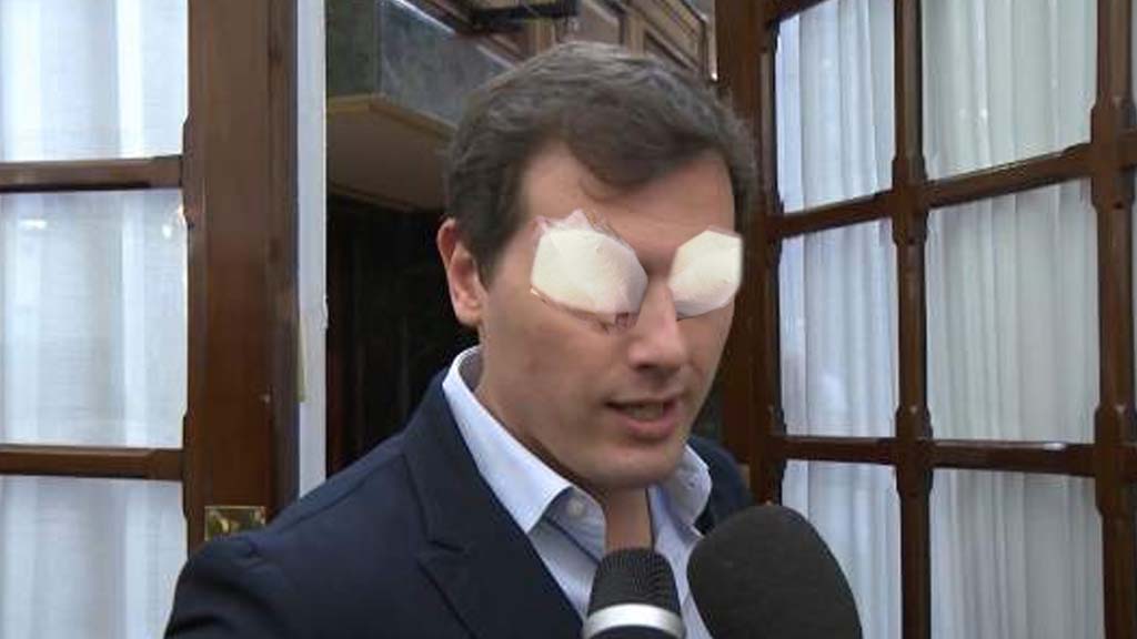 Un oftalmólogo extrae dos españoles de los ojos de Albert Rivera